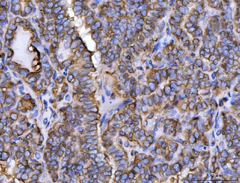 ERP29 Rabbit Polyclonal Antibody