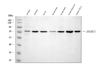 Adgrg1 Rabbit Polyclonal Antibody