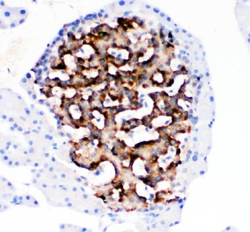 HSD11B1 Rabbit Polyclonal Antibody