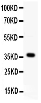 Protein Wnt-4 Wnt4 Rabbit Polyclonal Antibody