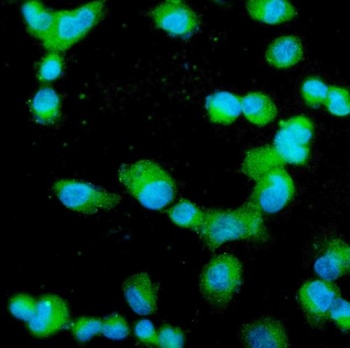 Profilin 2/PFN2 Rabbit Polyclonal Antibody