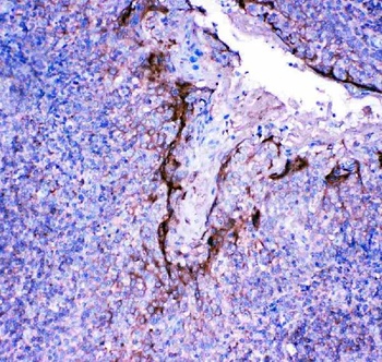 Profilin 2/PFN2 Rabbit Polyclonal Antibody