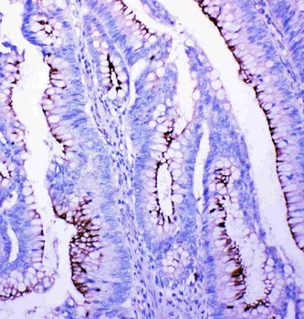 Profilin 2/PFN2 Rabbit Polyclonal Antibody