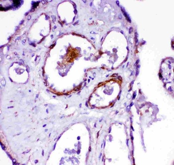 Angiotensin Converting Enzyme 1/ACE Rabbit Polyclonal Antibody