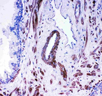 Angiotensin Converting Enzyme 1/ACE Rabbit Polyclonal Antibody