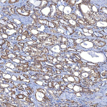 TRMT61A Rabbit Polyclonal Antibody