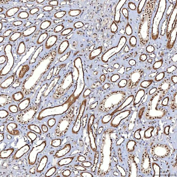 TRMT61A Rabbit Polyclonal Antibody
