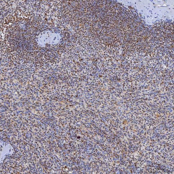 TRMT61A Rabbit Polyclonal Antibody