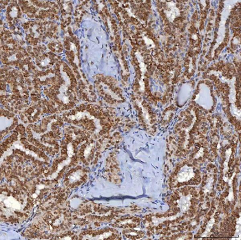 TRMT61A Rabbit Polyclonal Antibody