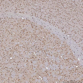 TRMT61A Rabbit Polyclonal Antibody