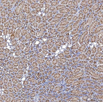 TRMT61A Rabbit Polyclonal Antibody