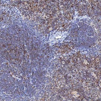 TRMT61A Rabbit Polyclonal Antibody