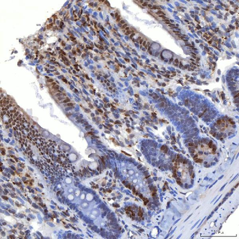 TRMT61A Rabbit Polyclonal Antibody