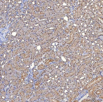 TRMT61A Rabbit Polyclonal Antibody