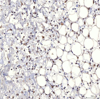 TRMT61A Rabbit Polyclonal Antibody