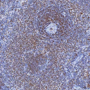 TRMT61A Rabbit Polyclonal Antibody