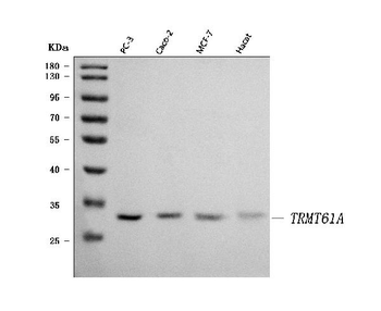 TRMT61A Rabbit Polyclonal Antibody