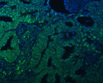 TRMT61A Rabbit Polyclonal Antibody