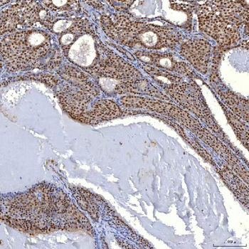 TRMT61A Rabbit Polyclonal Antibody