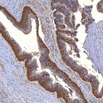 TRMT61A Rabbit Polyclonal Antibody