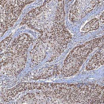 TRMT61A Rabbit Polyclonal Antibody