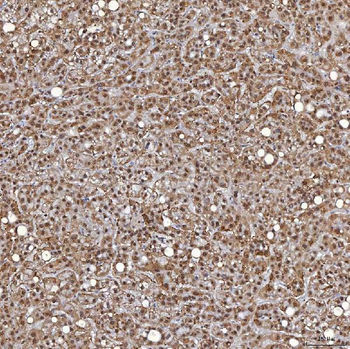 TRMT61A Rabbit Polyclonal Antibody