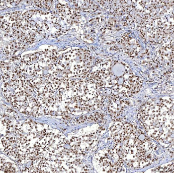 TRMT61A Rabbit Polyclonal Antibody