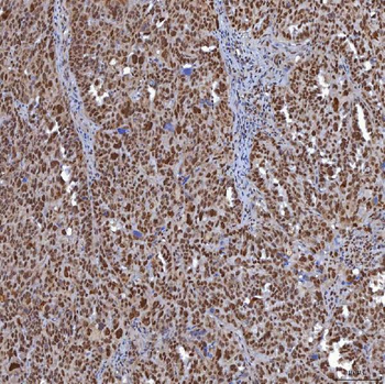 TRMT61A Rabbit Polyclonal Antibody