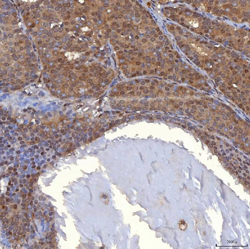 PIG3/TP53I3 Rabbit Polyclonal Antibody
