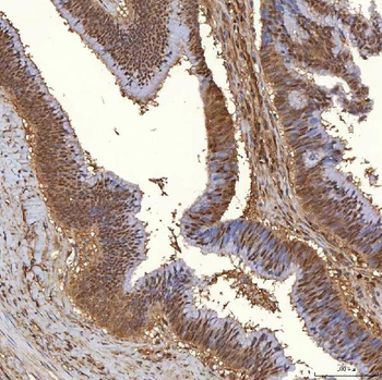 PIG3/TP53I3 Rabbit Polyclonal Antibody