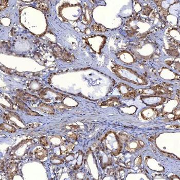PIG3/TP53I3 Rabbit Polyclonal Antibody