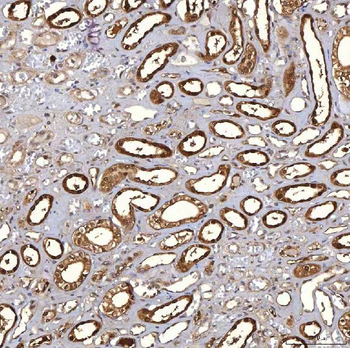 PIG3/TP53I3 Rabbit Polyclonal Antibody