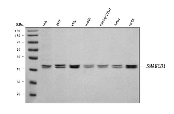 SNF5/SMARCB1 Rabbit Polyclonal Antibody
