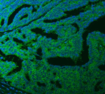 SLC40A1 Rabbit Polyclonal Antibody