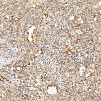 SLC40A1 Rabbit Polyclonal Antibody