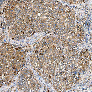 SLC40A1 Rabbit Polyclonal Antibody