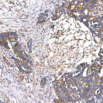SLC40A1 Rabbit Polyclonal Antibody