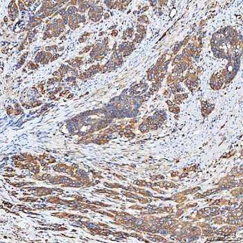 SLC40A1 Rabbit Polyclonal Antibody