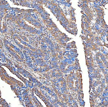 SLC40A1 Rabbit Polyclonal Antibody