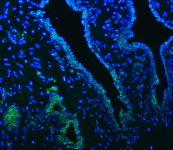 OAT3/SLC22A8 Rabbit Polyclonal Antibody