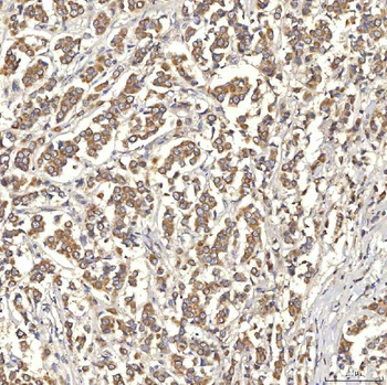 OAT3/SLC22A8 Rabbit Polyclonal Antibody