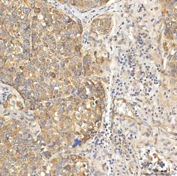 OAT3/SLC22A8 Rabbit Polyclonal Antibody