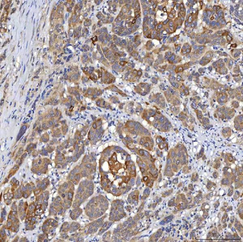 OAT3/SLC22A8 Rabbit Polyclonal Antibody