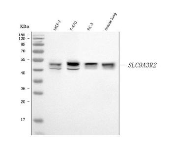 NHERF-2/SIP-1/SLC9A3R2/NHERF Rabbit Polyclonal Antibody
