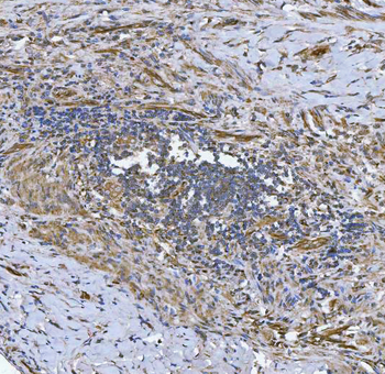 NHERF-2/SIP-1/SLC9A3R2/NHERF Rabbit Polyclonal Antibody