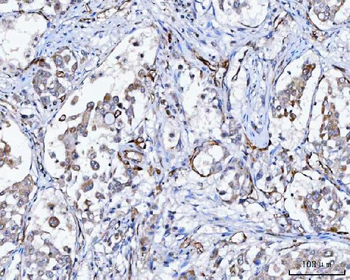 NHERF-2/SIP-1/SLC9A3R2/NHERF Rabbit Polyclonal Antibody
