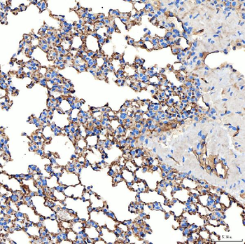 NHERF-2/SIP-1/SLC9A3R2/NHERF Rabbit Polyclonal Antibody