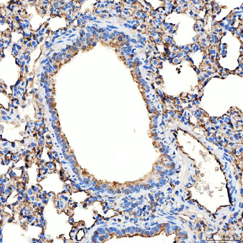 NHERF-2/SIP-1/SLC9A3R2/NHERF Rabbit Polyclonal Antibody