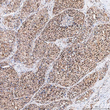 SINHCAF Rabbit Polyclonal Antibody