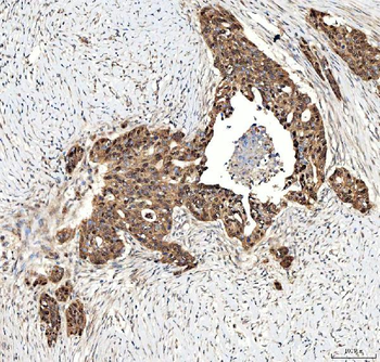 SINHCAF Rabbit Polyclonal Antibody